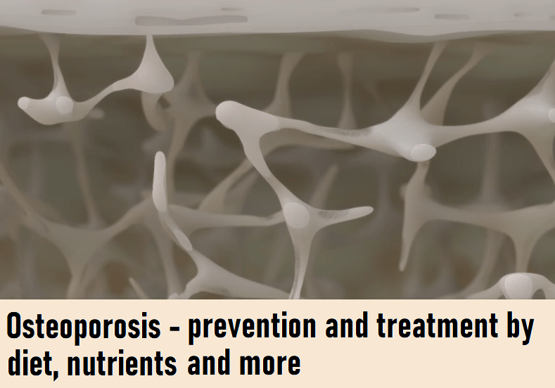 בריחת סידן –&nbsp;אוסטאופרוזיס