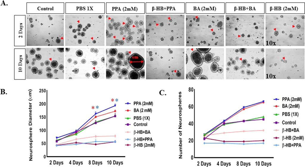 חומצה פרופיונית –&nbsp;אוטיזם
