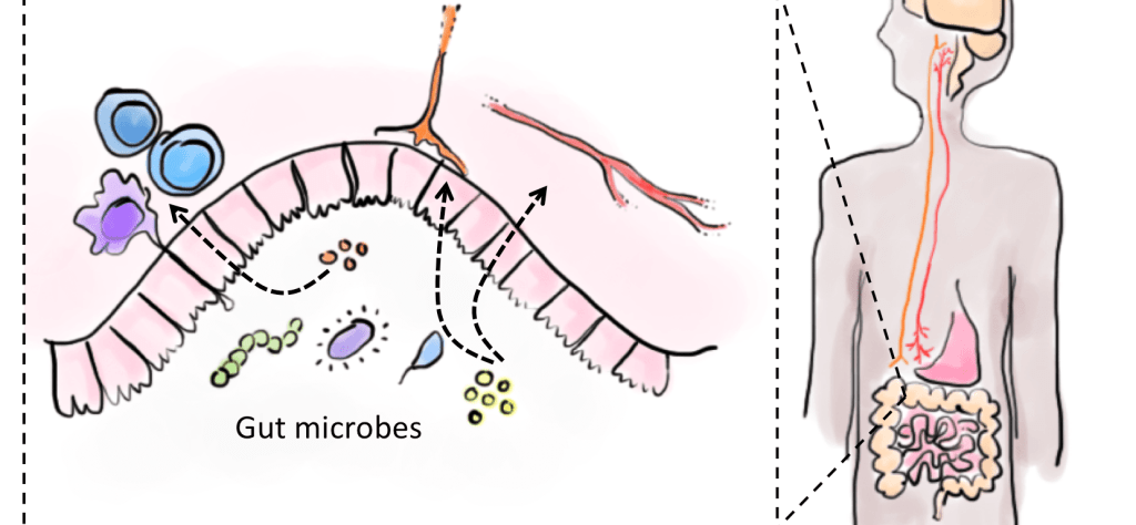הקשר שבין אנטיביוטיקה&nbsp;ל-ADHD