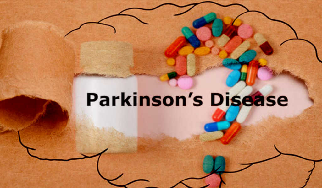 אנטיביוטיקות נפוצות גורמות&nbsp;לפרקינסון