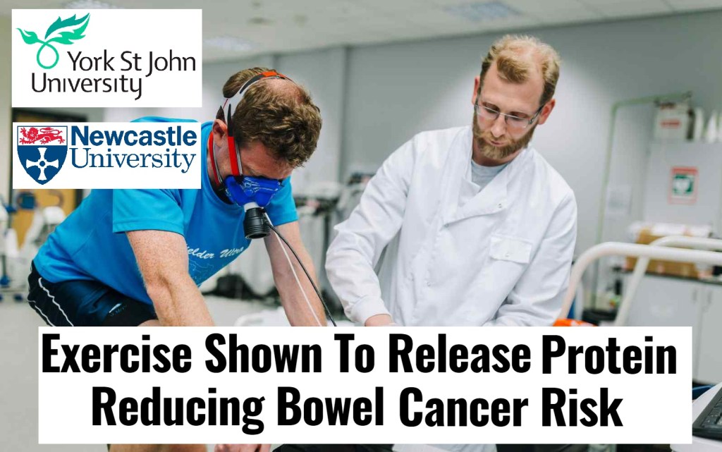 פעילות גופנית מפחיתה את הסיכון לסרטן המעי ומאריכה חיים של&nbsp;חולים