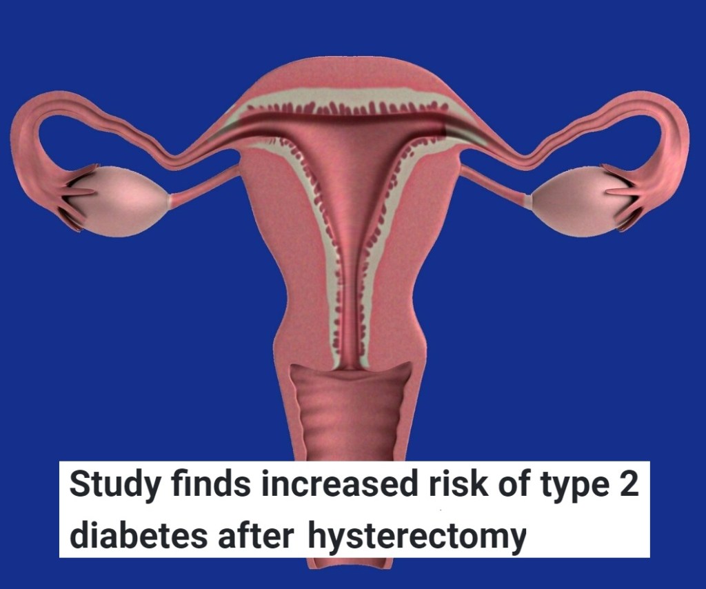 נשים שעוברות כריתת רחם עשויות להיות בסיכון גבוה יותר לפתח סוכרת מסוג 2 ומחלות לב וכלי&nbsp;דם