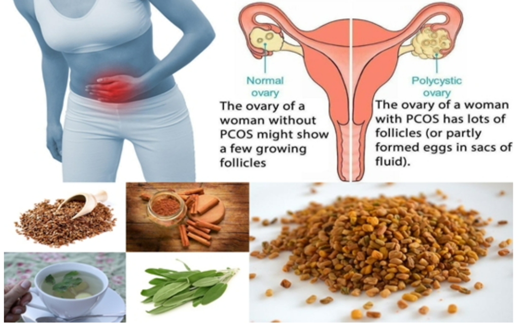 שחלות פוליציסטיות – גורמי סיכון ודברים למניעה&nbsp;וטיפול