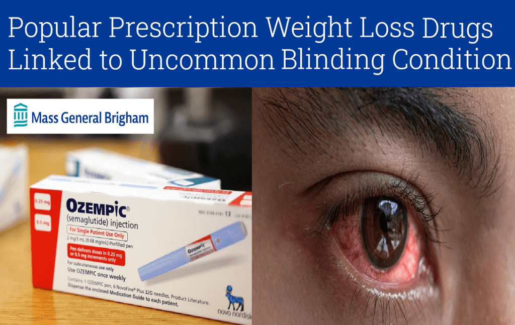 תופעות הלוואי של תרופות פופולריות לירידה במשקל&nbsp;מתרבות