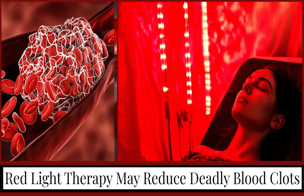 אור אדום וקרישי&nbsp;דם